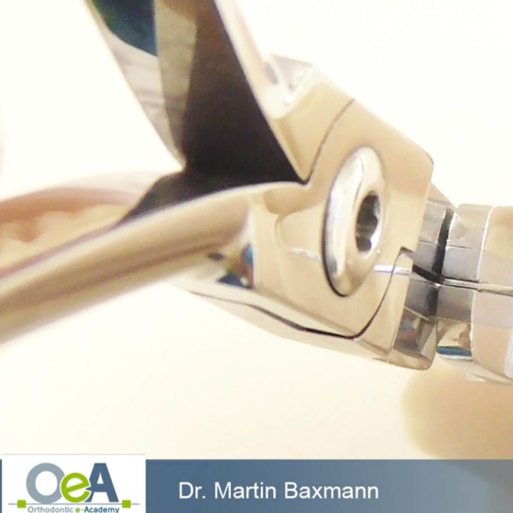 6 Arten der Verschwendung in der kieferorthopädischen Praxis